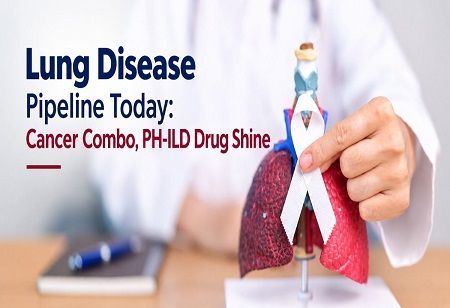Lung Disease Pipeline Today: Cancer Combo, PH-ILD Drug Shine India Pharma Outlook 